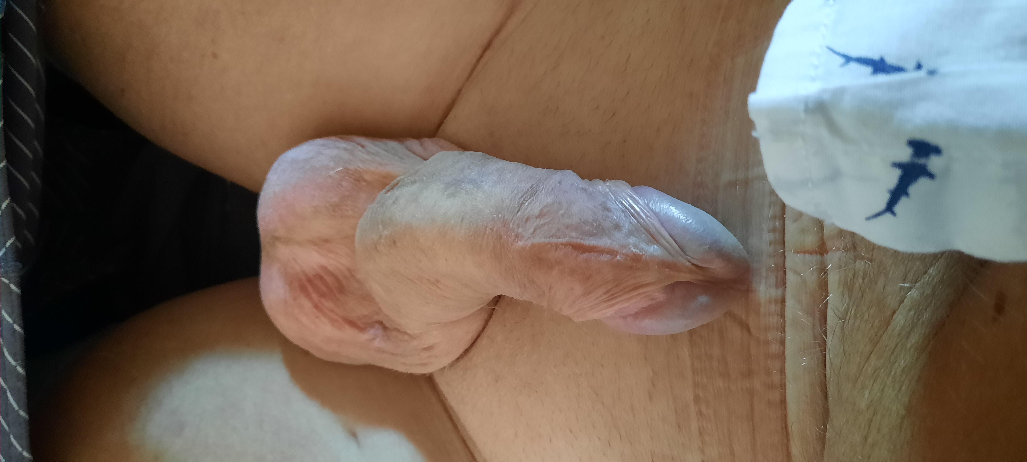 Ik Zou Graag Afgetrokken Worden Door Een Oudere Vrouw. Gehandicapten