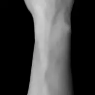 Who Wants My Arm Voeten Fetish
